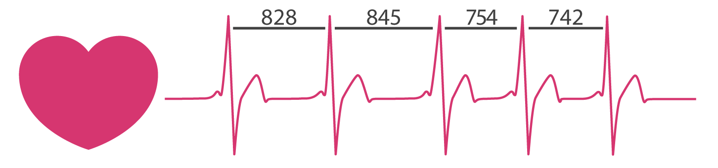 Heart rate variability graph