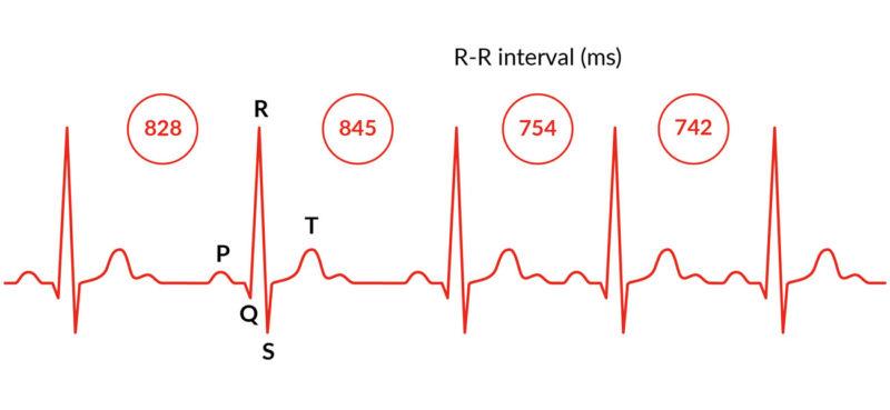 Firstbeat Herzratenvariabilität