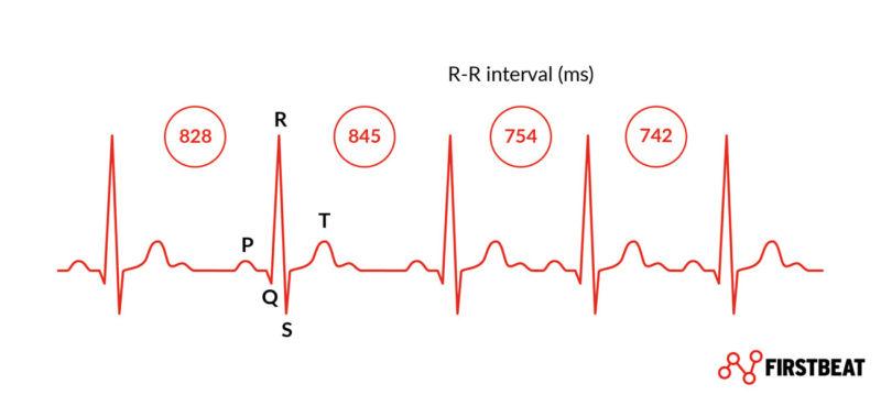  Heart rate variability (HRV) - R-R-interval